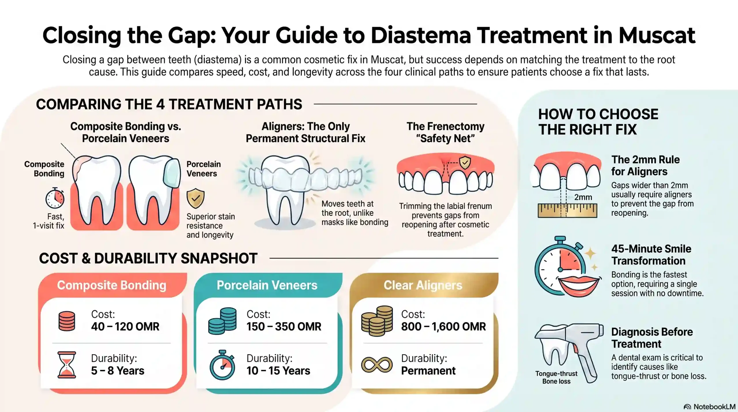 Comparison infographic of the 4 diastema treatment options: bonding, veneers, clear aligners, and frenectomy